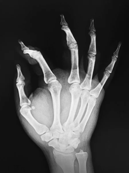 human hand with black and white medical mask