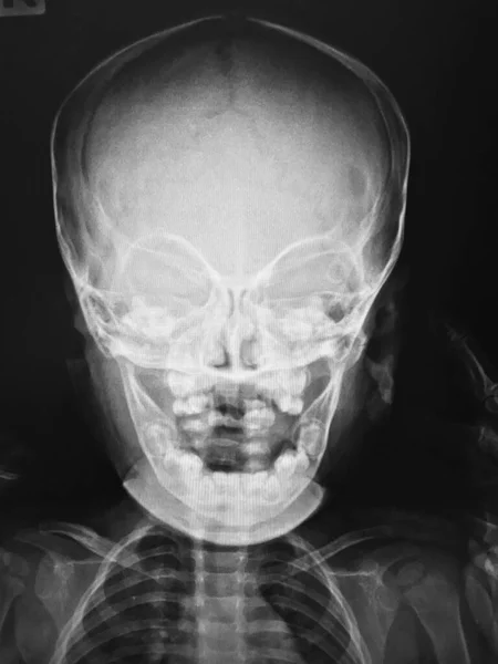 人体的 线扫描 — 图库照片