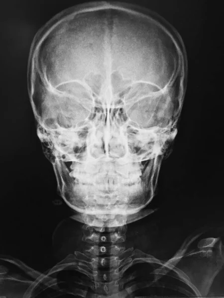 Anatomie Des Menschlichen Gehirns Röntgen — Stockfoto