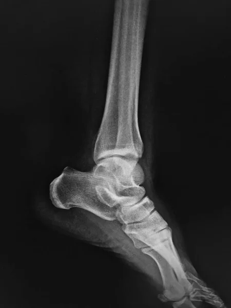 Анатомія Людини Рентгенівський — стокове фото
