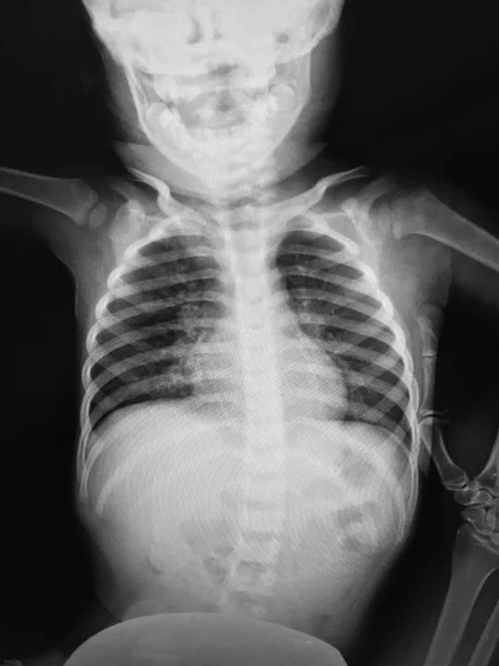 human radiography anatomy. x-ray.