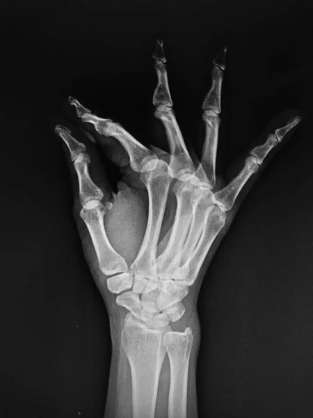 Ανθρώπινο Χέρι Αίμα Απομονωμένο Μαύρο Φόντο — Φωτογραφία Αρχείου