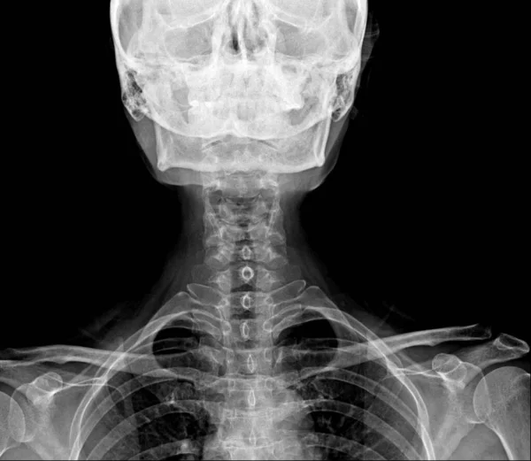 Film Ray Skull Cervical Spine Lateral View — Stock Photo, Image