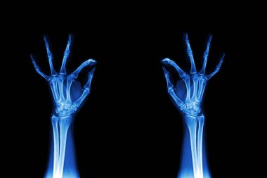 İnsan iskeleti anatomisi tıbbi konsept 3 boyutlu tıbbi konsept