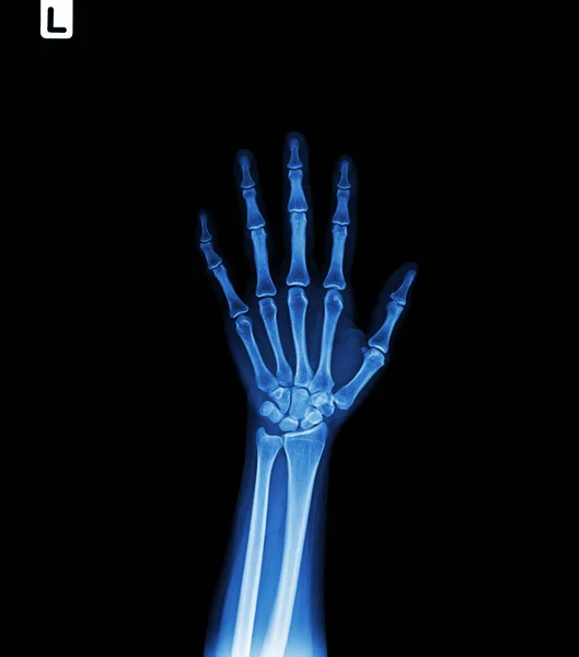 Hand Van Menselijke Vinger Zien Aan Straal Van Arm — Stockfoto