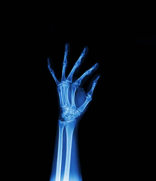 Луч Человеческой Руки Черном Фоне — стоковое фото