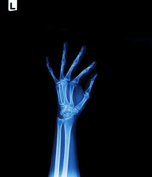 Menselijk Skelet Hand Anatomie Hologram Bot Rendering Voor Medische Kliniek — Stockfoto