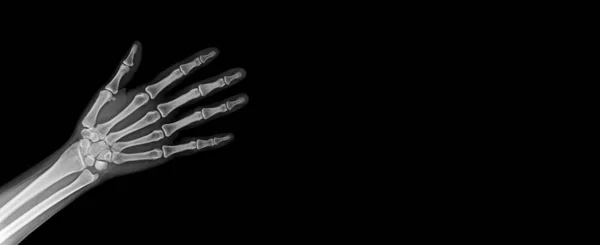 Human Skeleton Hand Anatomy — Stock Photo, Image