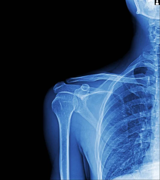 Röntgen Patientens Huvud — Stockfoto