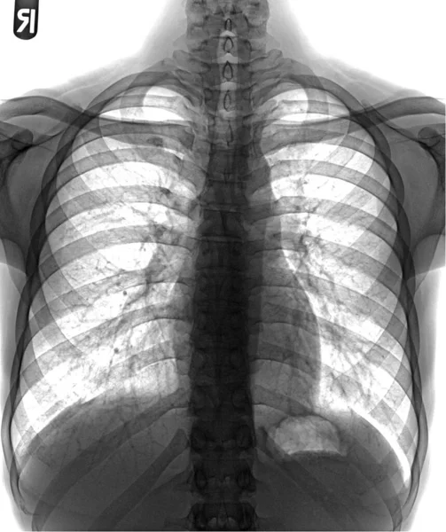 Human Respiratory System Anatomy Anatomy — Stock Photo, Image