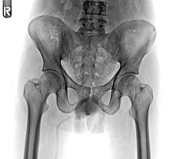 Human Knee Anatomy Ray — Stock Photo, Image