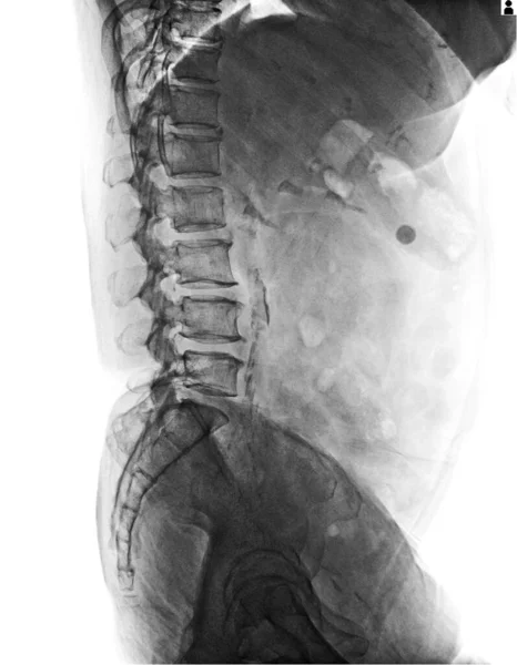 Spine Human Spine — Stock Photo, Image