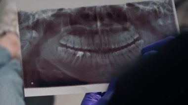 Diş kliniğinde koruyucu maskeli iki doktor hasta kıza hizmet ediyor. İş Dişçiliği. Sağlık ve Tıp Konsepti.