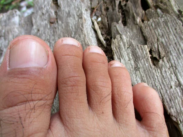 Photo of an adult human right toe