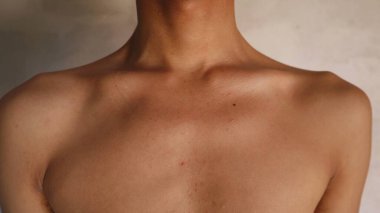 Zayıf bir adamın omuz ve göğüs bölgesinin fotoğrafı. Asimetrik bir vücut şekli görebilirsiniz. Görünür vücut kemikleri.