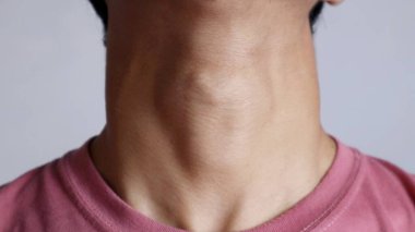 Beyaz arka planda bir adamın Adem elması ve boyun bölgesinin fotoğrafı.