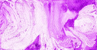 Mor, pembe ve beyaz renklerin farklı tonlarının soyut mermer arka planı. Kaotik noktalar, noktalar, sıçramalar ve çizgiler. Belirsiz noktalar. Bazı yerlerde daha doygun ve karanlık olurlar..