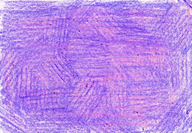 Kaotik darbelerin dokusuyla dolu bir arka plan. Renkli kalemlerle, tebeşirle, mum kalemlerle vuruşlar. Morun farklı tonları. Mavi, pembe renk. Beyaz arka plan görünür. Mor, siyah noktalar.