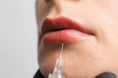 Beauty treatments by a beautician close up. The concept of improving the appearance. Lip augmentation, symmetry, plump lips. New techniques in cosmetology. Gloved hands. Syringe in hand.