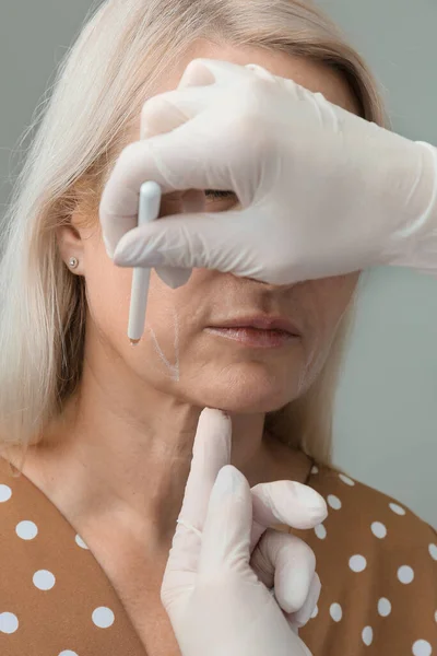 Thread Facelift Concept Lifting Skin Procedure Facial Contouring Using Mesothreads — Stockfoto