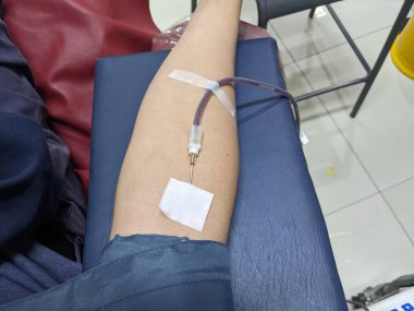 Kan bağışı için iğne batırılmış bir kişinin kolu. Fotoğraf sağlık afişi ve kan bağışı içeriği medyası için uygundur.. 