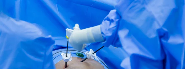 Doctor in blue sterile surgical gown suite doing minimal invasive surgery with camera and instrument.Keyhold surgery was perform in modern operating room.Advanced surgery.