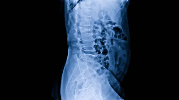 Plain Radiograph Dark Background Hospital Ray Used Diagnosis Illness Patient — Stock Photo, Image