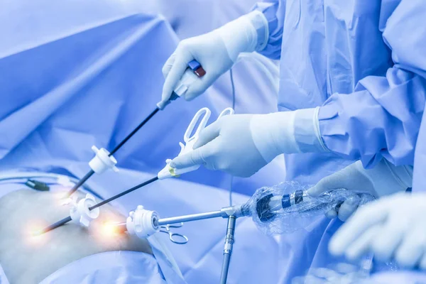 医生小组在医院手术室内做腹腔镜胆囊切除术 外科医生持有微创内窥镜手术的医疗仪器或外科设备 效果很好 — 图库照片