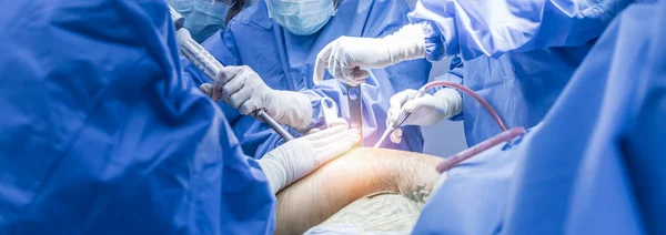 Panorama Pankartı Ameliyathanede Doktor Hemşire Ekibi Ameliyathanede Ameliyat Yapıyor Tıbbi — Stok fotoğraf