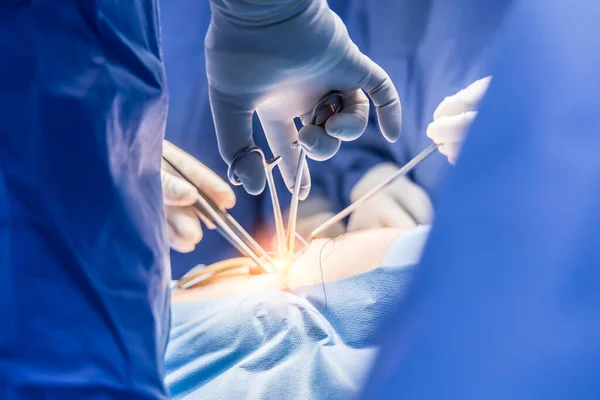 青い制服の外科医または医師は オレンジ色の光の効果とぼやけた背景を持つ外科病院で手術をしました 手術室では外科医や看護師が医療機器や機器を使用します — ストック写真