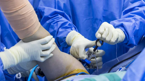 Orvos Csapata Artroszkópos Ortopéd Vállműtétet Végzett Műtőben Kórházban Kék Egyenruhában — Stock Fotó