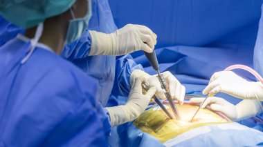 Omurga cerrahı ya da mavi üniformalı doktor hastanedeki ortopedik ameliyathanede. İnsanlar omurilik ameliyatı yaptı. Tıbbi aletlerle veya teçhizatla cerrahın eli. Pediküler vida nakledildi..