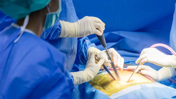 Gerincsebész Vagy Kék Egyenruhás Orvos Csapata Ortopéd Műtőben Kórházban Gerincműtétet — Stock Fotó