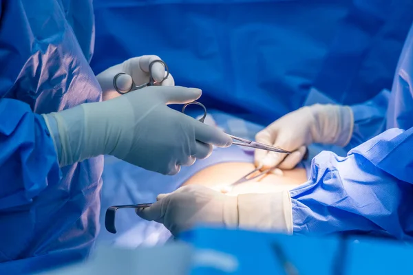 青い制服の看護チームの外科医か医者は病院の手術室内で手術をした 軽い外科用クランプおよび医療機器を保持している外科医緊急手術が行われた — ストック写真