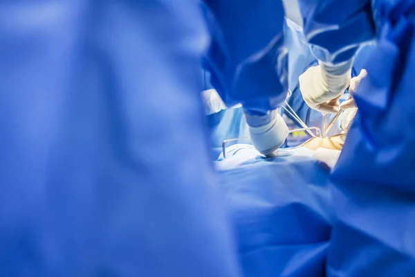 Tim Dokter Atau Ahli Bedah Dengan Seragam Biru Melakukan Operasi — Stok Foto