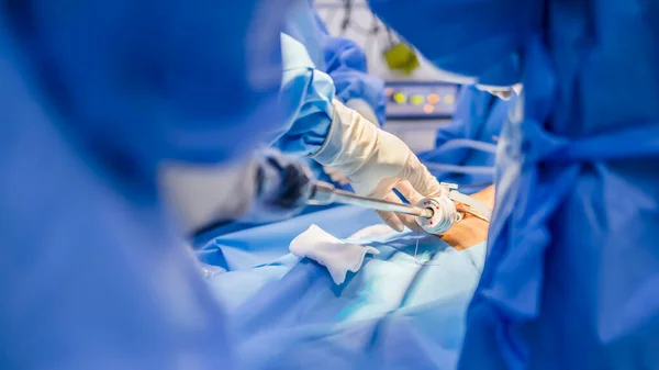 在腹腔镜胆囊切除术期间 身穿蓝色长袍的外科医生或医生将医疗器械或器械放置在手术室的摄像头门口 肥胖外科治疗的钥匙孔手术技术 — 图库照片