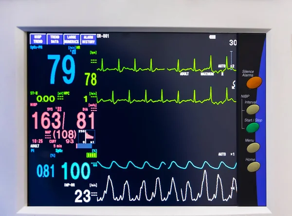 Schermo Monitoraggio Del Segno Vitale Medico Sala Operatoria Ospedale Frequenza — Foto Stock