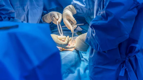 医師または外科医は 病院の手術室内でヘルニアメッシュ修復手術を行いました 大質量患者における鼠径ヘルニアのオープン修復 ぼやけた背景で医療用メッシュデバイスが使用されました — ストック写真