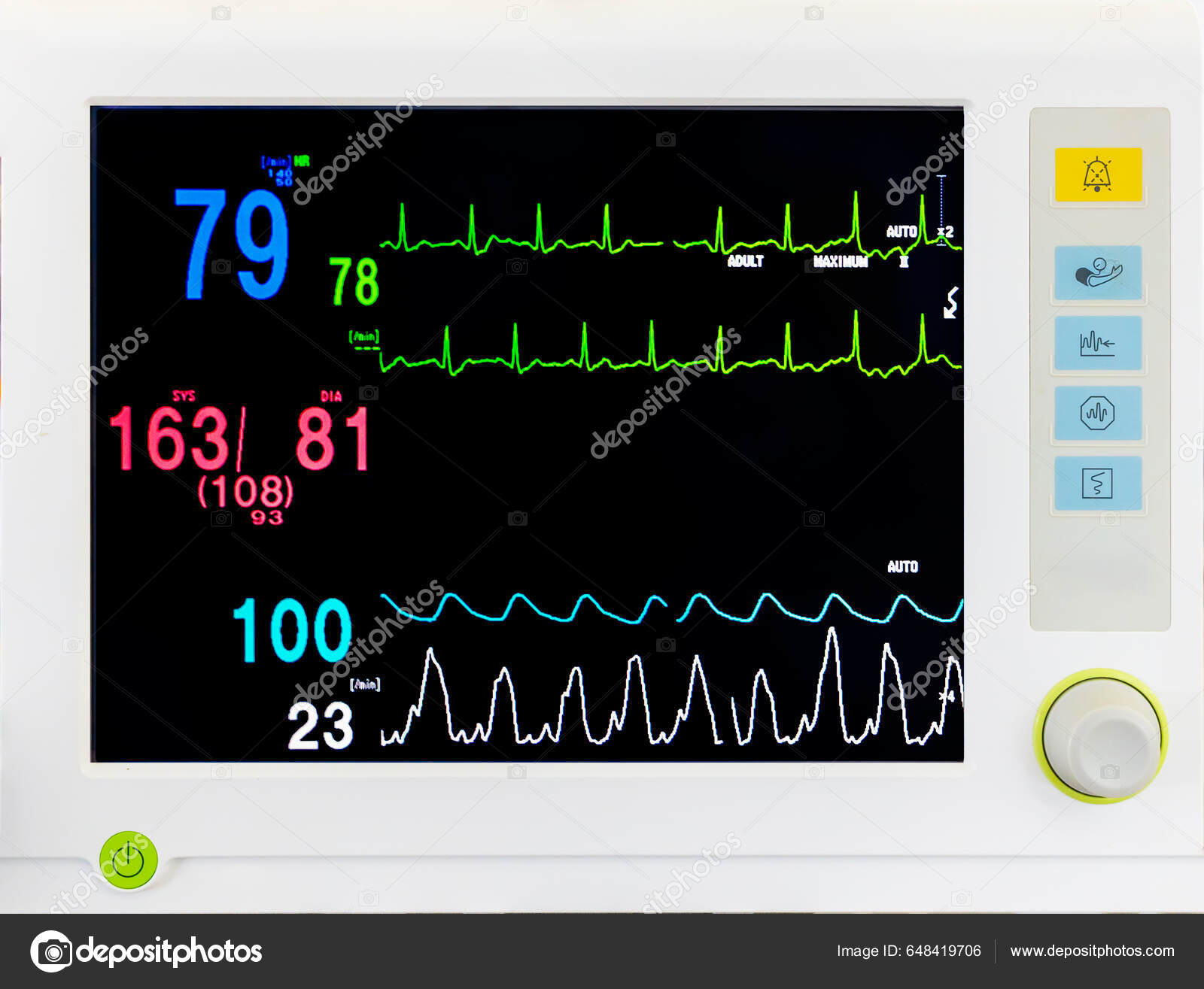 https://st5.depositphotos.com/76079652/64841/i/1600/depositphotos_648419706-stock-photo-medical-vital-sign-monitor-screen.jpg