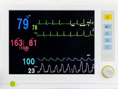 Ameliyathanede ya da hastanede hayati gösterge ekranı var. Kalp atışı ya da kan basıncı kaydedildi. Normal oksijen seviyesi. Siyah arka plan EKG grafiği. Renkli rakamlar hipertansiyonu gösteriyor..