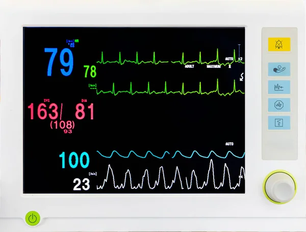 Medical Vital Sign Monitor Screen Operating Room Hospital Heart Rate Stock  Photo by ©cvtman@hotmail.com 648419706