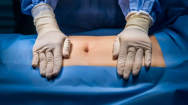 医生或护士身穿蓝色制服的病人手戴手套 住院手术室内的腹部手术 疝修补手术 — 图库照片