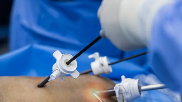 Sebész Vagy Orvos Minimális Invazív Laparoszkópos Cholecystectomia Műtét Belül Műtő — Stock Fotó