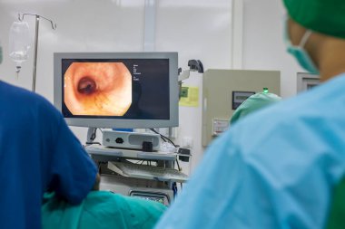 Açık mavi önlüklü bir doktor ya da cerrah hastanedeki ameliyathanede kolonoskopi ya da gastroskopi yaptı. Kanser taraması için EGD teknolojisi. Bulanık yeşil arka plan ve ön plan..