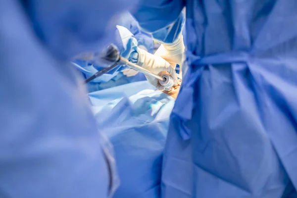 青いガウンの医師や外科医は 病院の手術室内にカメラ装置を挿入します 人々は腹腔鏡や内視鏡手術で最小限の侵襲手術技術を行いました 看護師やチームの手 — ストック写真