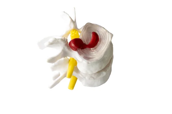 Modelo Isolado Anatomia Coluna Vertebral Fundo Espaço Branco Educação Cirurgia — Fotografia de Stock