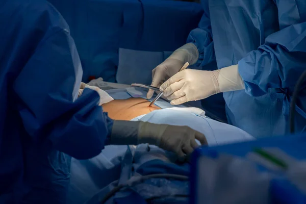 穿蓝色手术礼服的医生或外科医生在医院手术室里做手术 病人全麻后进行感觉测试 — 图库照片