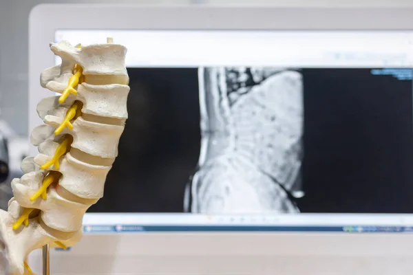 Model Kręgosłupa Lub Makiety Wewnątrz Jednostki Ortopedycznej Szpitalu Komputerem Rozmytym — Zdjęcie stockowe
