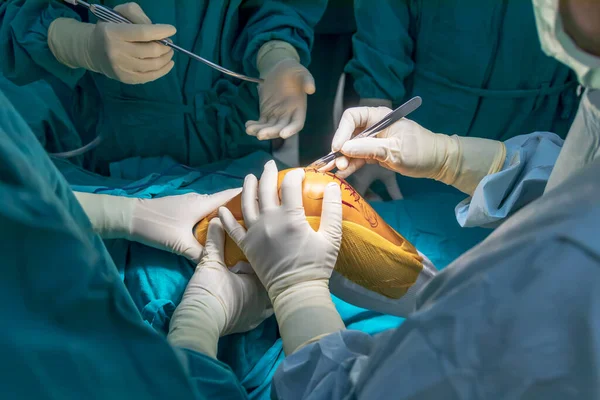 手術室内に医療用メスやナイフを持つ緑色の制服を着た医師や整形外科医 医療用手袋付き — ストック写真
