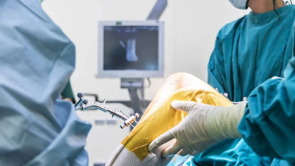 Mavi Elbiseli Doktor Cerrah Ameliyat Odasında Robotik Navigatör Diz Eklemi — Stok fotoğraf